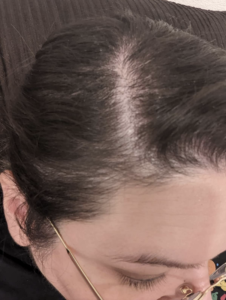 hair growth oils