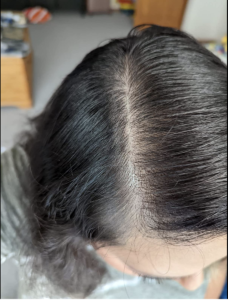 hair growth oils
